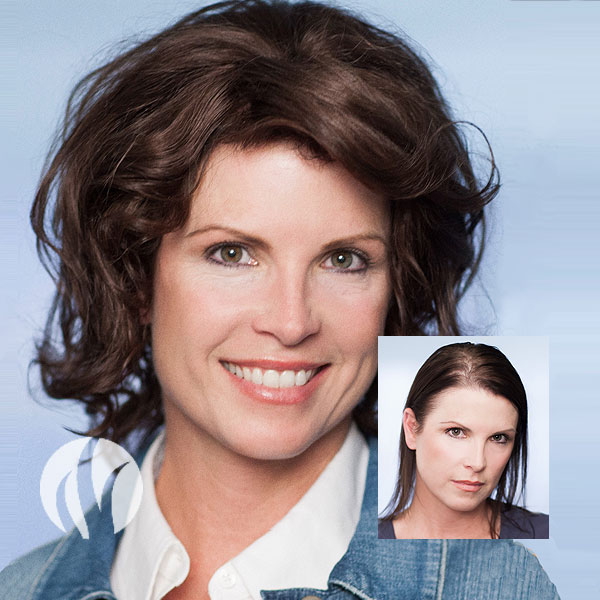 Women's Hair Restoration - Tupelo, MS