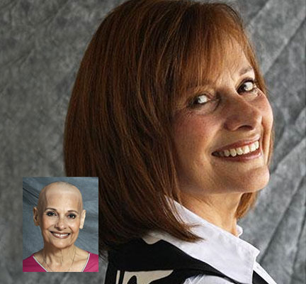 womens non-surgical hair replacement restoration tupelo oxford starkville ms
